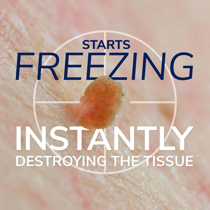 Dr. Scholl's Freeze Away Skin Tag Remover Kit, 8 ct – Completely removes Skin Tags in As Little As 1 Treatment, FDA-Cleared & Clinically Proven