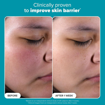 Paula's Choice SKIN PERFECTING 2% BHA Liquid Exfoliant Polish, Salicylic Acid Exfoliant-Facial Polish for Enlarged Pores, Wrinkles & Fine Lines,...